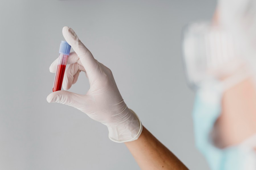 Doctor holding a vial of blood