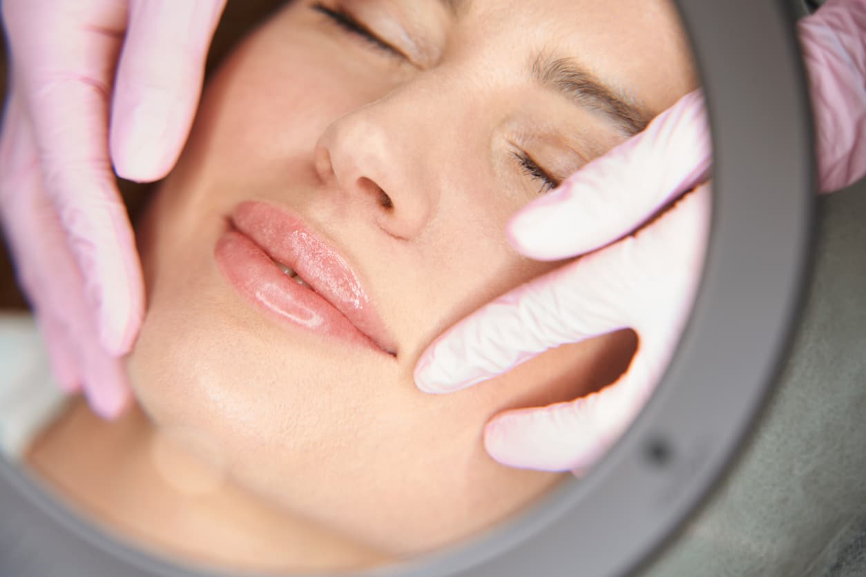 lip filler treatment