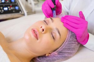 microneedling for wedding skin prep