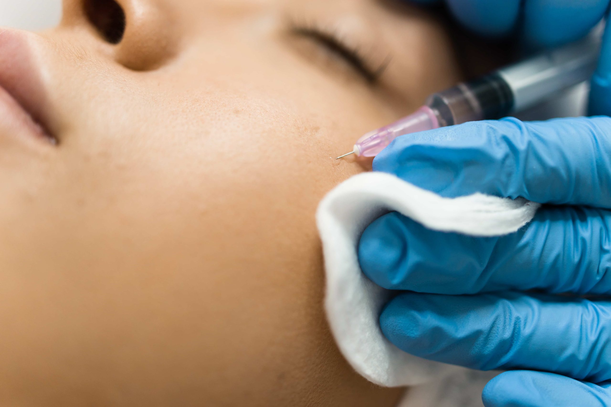 A woman receiving a Sculptra injection to the cheek at Coastal Health & Medical Spa in Jacksonville