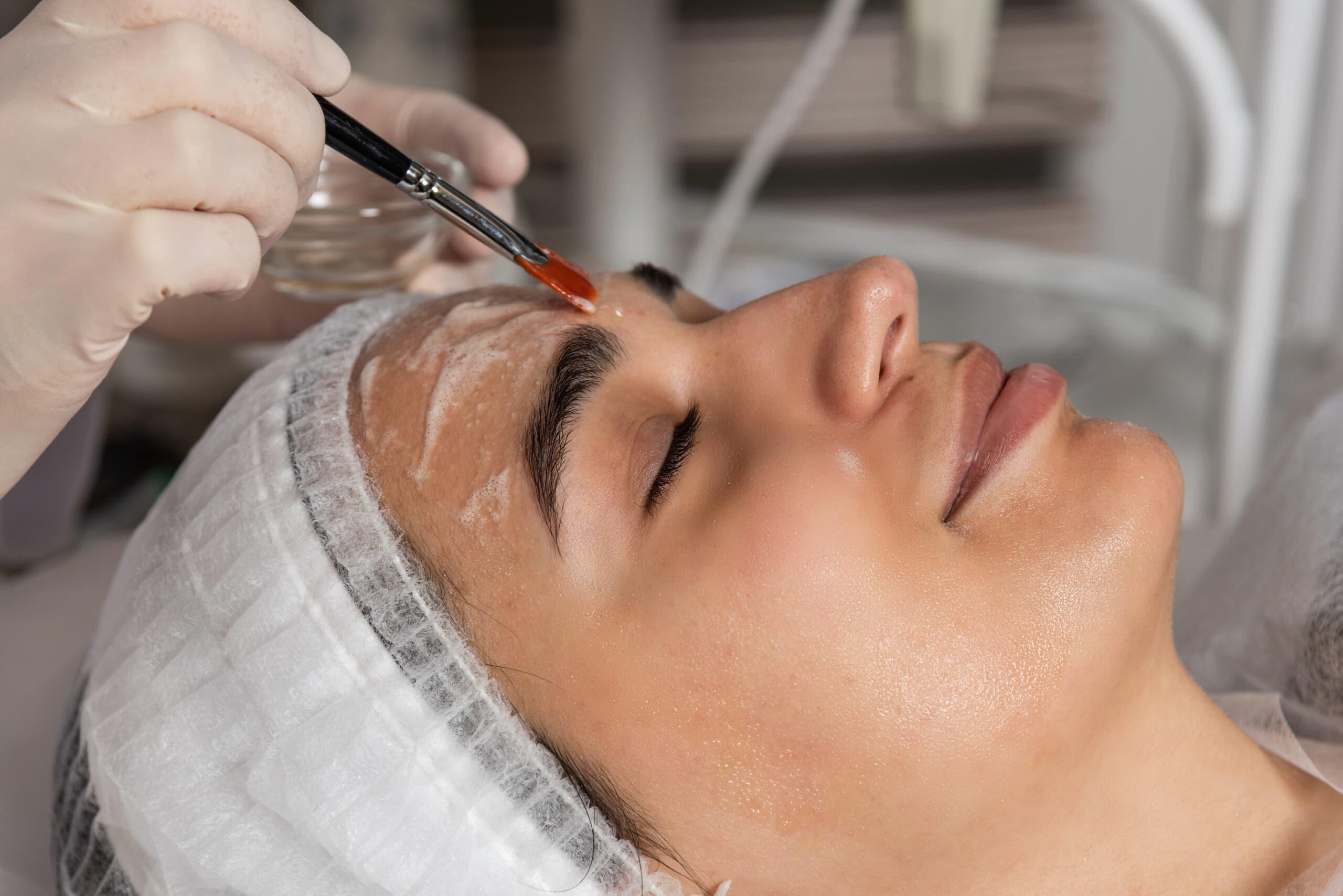 A light chemical peel being done on a woman in a medical spa