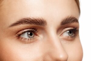 Woman with a Botox brow lift
