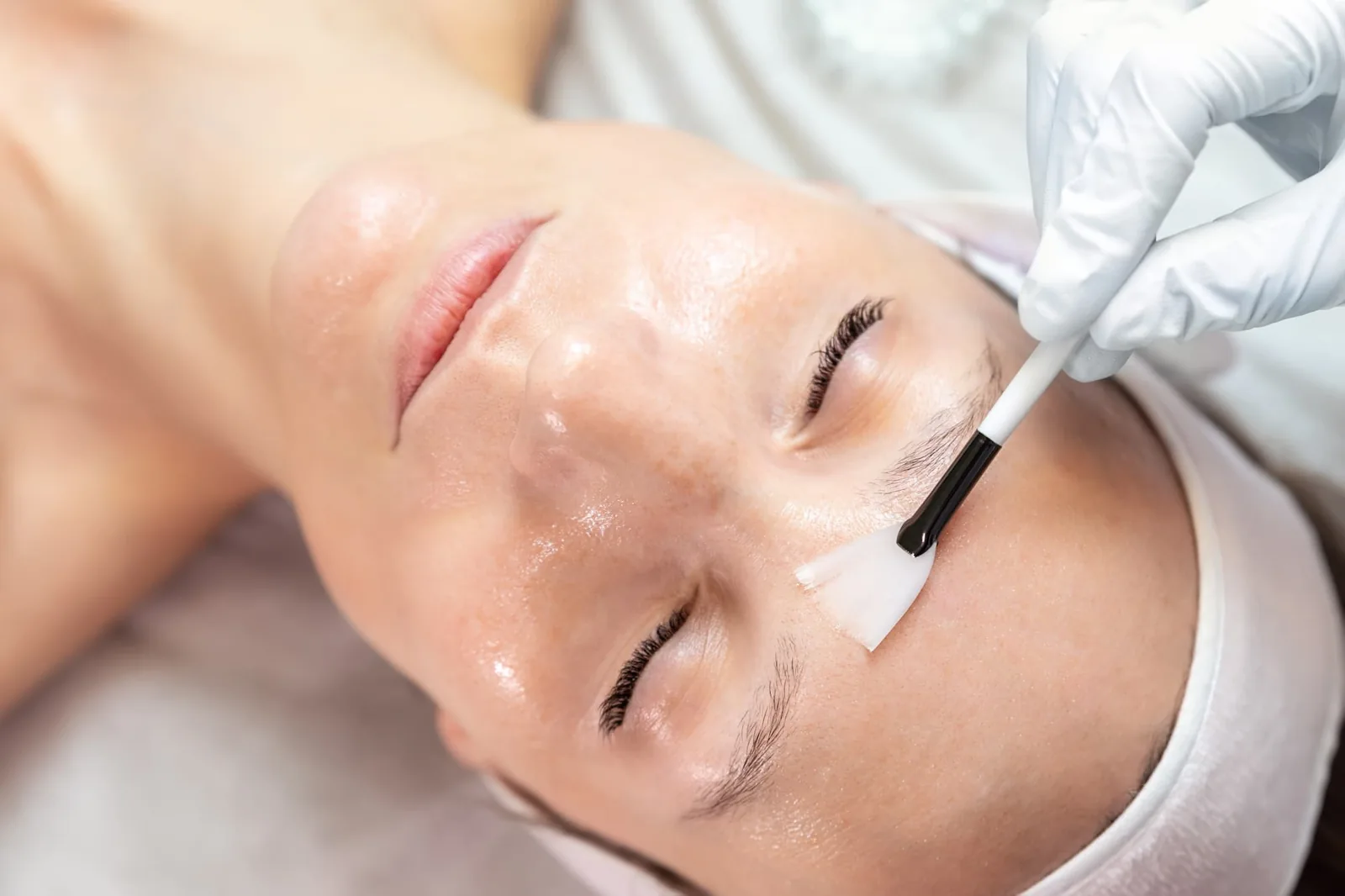 A young woman getting a chemical peel treatment on her face at Coastal Health & Medical Spa in Jacksonville