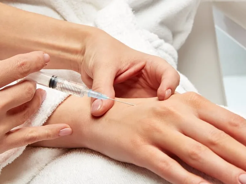 Dermal filler being injected into the back of a patient's hand during a hand filler treatment in Jacksonville, FL