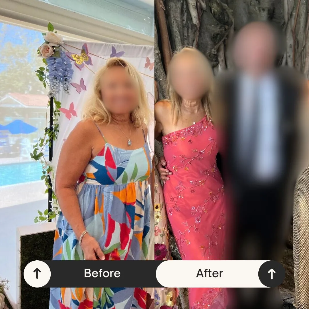 Before and after photos of a Coastal Health & Medical Spa medical weight loss patient in Jacksonville with faces blurred for privacy, individual results vary