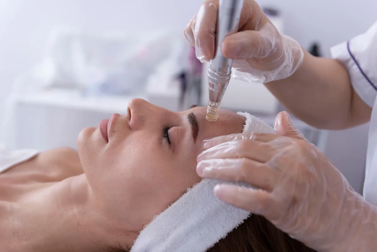 A provider gliding a microneedling pen across a patient's forehead, the treatment that microneedling aftercare do's and don'ts protect.