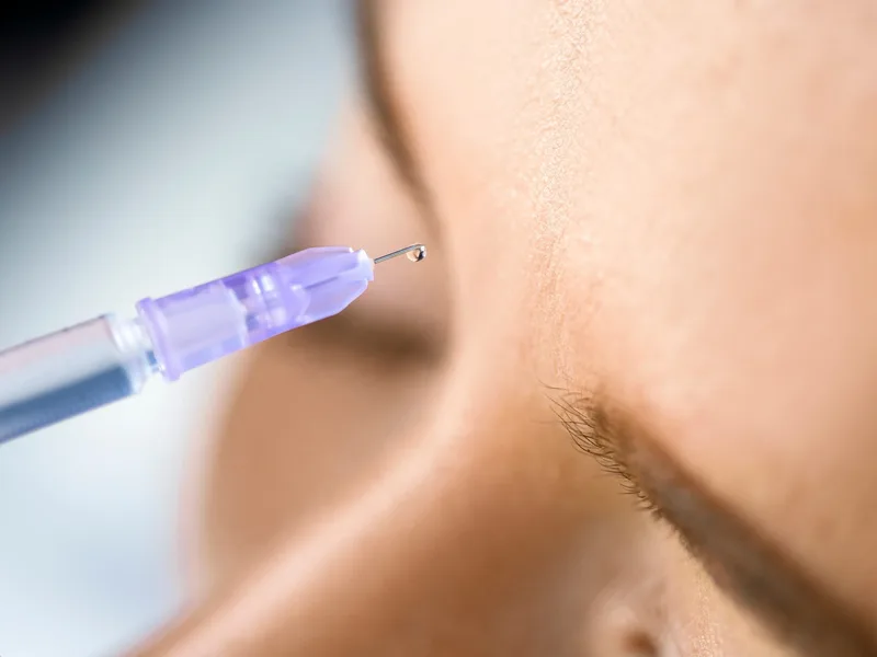 Fine needle positioned near a patient's under-eye area for an under eye filler treatment at a Jacksonville med spa