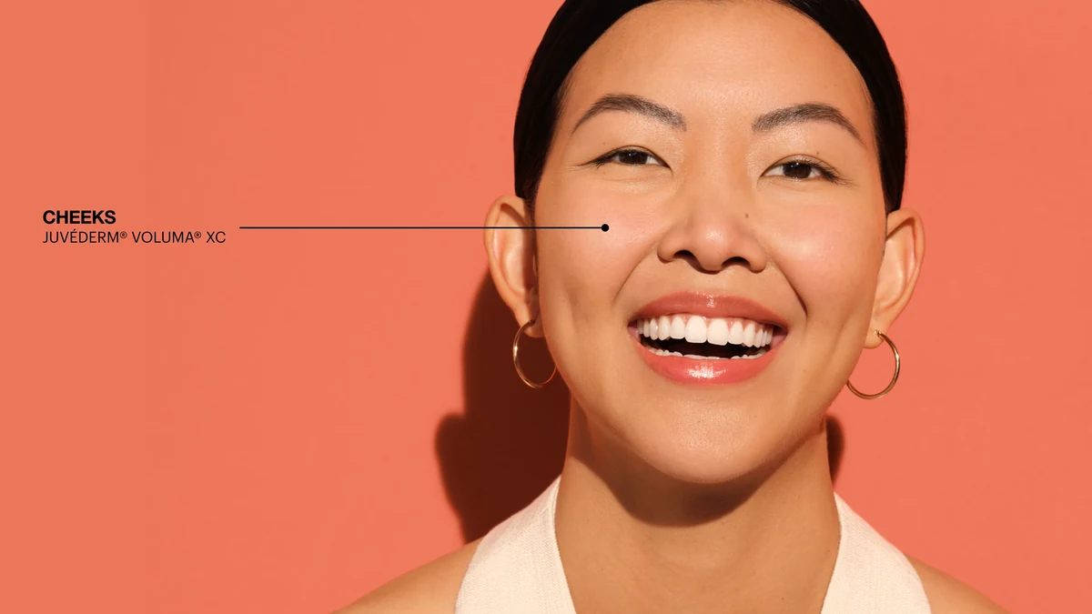 Juvederm Voluma XC campaign image; Voluma XC is a structural hyaluronic acid filler used for the nasal bridge and tip at Coastal Health & Medical Spa (image courtesy of Juvederm)
