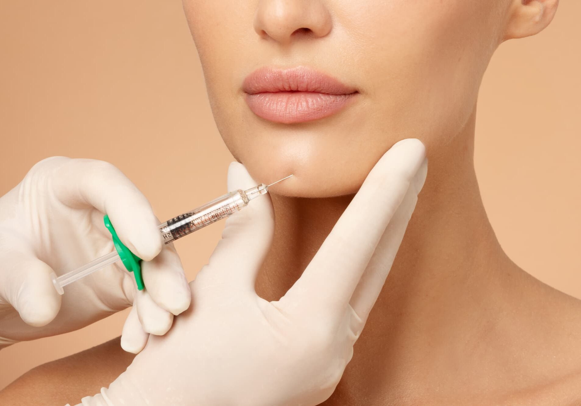 Woman getting Restylane Defyne treatment in Jacksonville