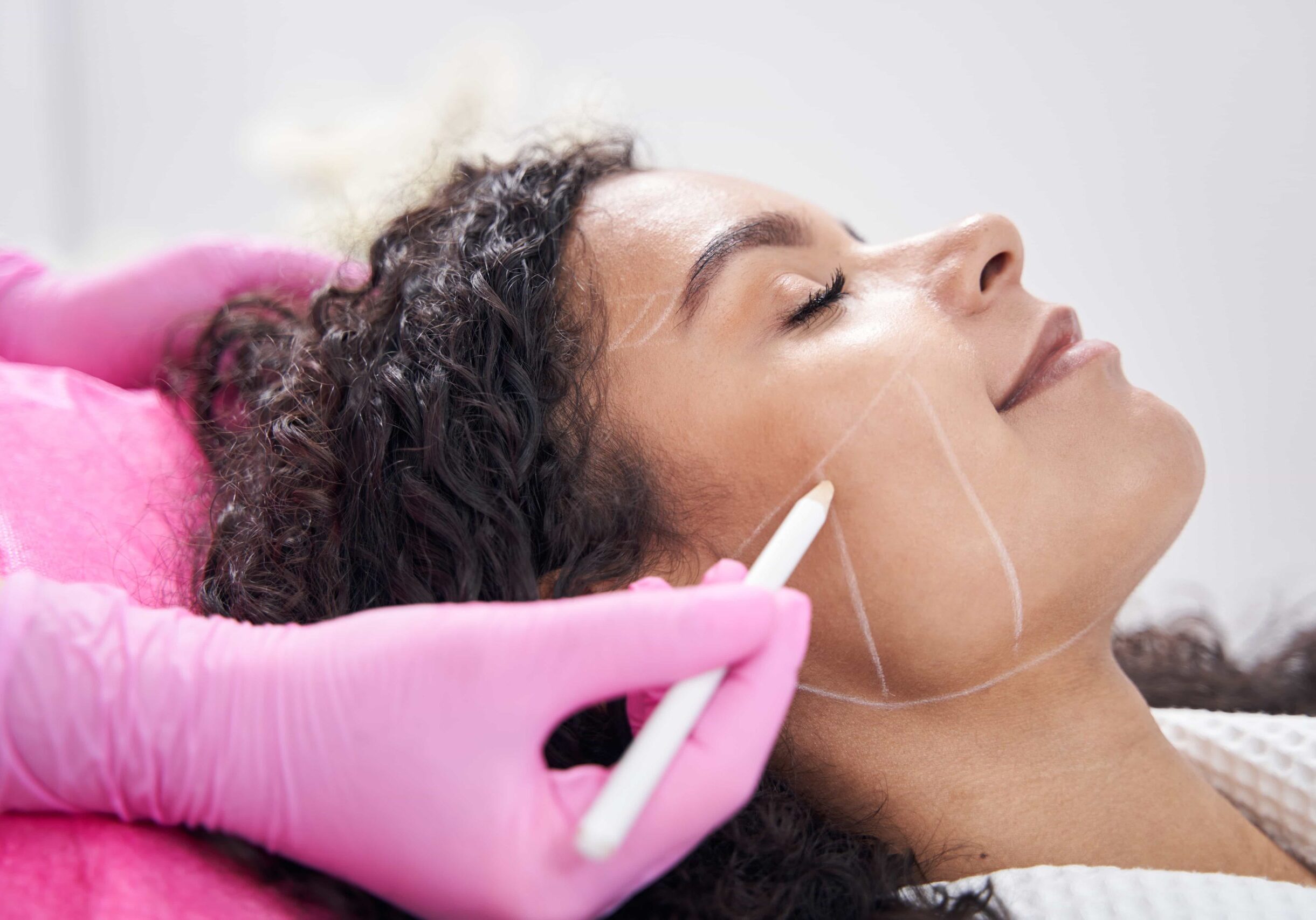 Woman getting cheek filler in Jacksonville