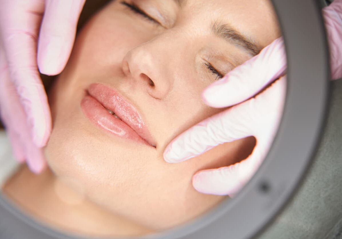 lip filler treatment