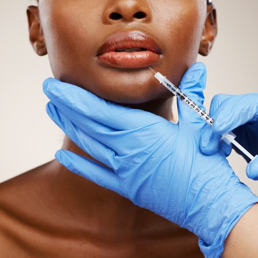 lip fillers
