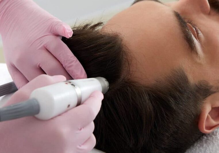 hair restoration jacksonville